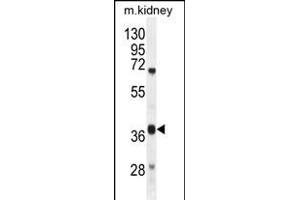 DUS4L Antibody (Center) (ABIN654982 and ABIN2844622) western blot analysis in mouse kidney tissue lysates (35 μg/lane). (DUS4L antibody  (AA 141-170))