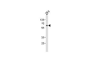 Western blot analysis of lysate from ZF4 cell line, using (DANRE) camk2d2 Antibody (ABIN657721 and ABIN2846708). (CAMK2D antibody  (AA 221-250))