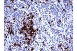 Image no. 3 for anti-Thymidylate Synthetase (TYMS) antibody (ABIN1501595)