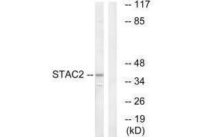 Western blot analysis of extracts from K562 cells, using STAC2 antibody. (STAC2 antibody)