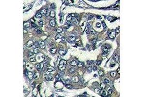 Immunohistochemistry (IHC) image for anti-Eukaryotic Translation Initiation Factor 4E Family Member 2 (EIF4E2) (AA 12-41) antibody (ABIN3030894)