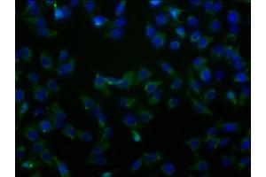 Immunofluorescence staining of HepG2 cells with ABIN7170175 at 1:100, counter-stained with DAPI. (SLC23A2 antibody  (AA 1-92))