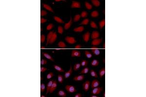 Immunofluorescence analysis of U2OS cell using CD3E antibody. (CD3 epsilon antibody  (AA 25-207))