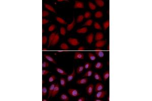 Immunofluorescence analysis of U2OS cell using CD3E antibody. (CD3 epsilon antibody  (AA 25-207))