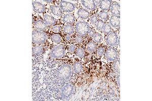 Immunohistochemical analysis of paraffin-embedded Human colon tissue using C performed on the Leica® BOND RXm. (Haptoglobin antibody  (Center))