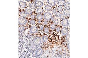 Immunohistochemical analysis of paraffin-embedded Human colon tissue using C performed on the Leica® BOND RXm.