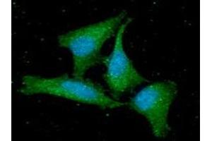 ICC/IF analysis of GMFB in HeLa cells line, stained with DAPI (Blue) for nucleus staining and monoclonal anti-human GMFB antibody (1:100) with goat anti-mouse IgG-Alexa fluor 488 conjugate (Green). (GMFB antibody  (AA 1-142))