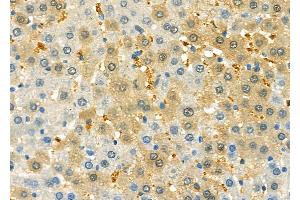 ABIN6261280 and ABIN6279617 at 1/100 staining Rat liver tissue by IHC-P. (Non-Syndromic Hearing Impairment Protein 5 (GSDME) (C-Term) antibody)