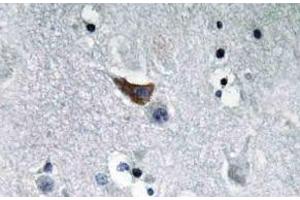 Immunohistochemistry (IHC) analyzes of GluR1 antibody in paraffin-embedded human brain tissue. (Glutamate Receptor 1 antibody)