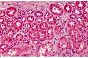 Human Kidney: Formalin-Fixed, Paraffin-Embedded (FFPE) (LGI3 antibody  (Internal Region))