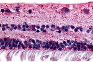 Anti-RGR antibody  ABIN1049289 IHC staining of human retina. (RGR antibody  (Extracellular Domain))