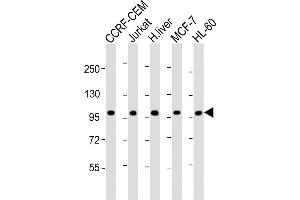 All lanes : Anti-RSBN1 Antibody (N-term) at 1:2000 dilution Lane 1: CCRF-CEM whole cell lysate Lane 2: Jurkat whole cell lysate Lane 3: human liver lysate Lane 4: MCF-7 whole cell lysate Lane 5: HL-60 whole cell lysate Lysates/proteins at 20 μg per lane. (RSBN1 antibody  (N-Term))