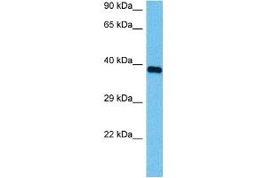 Host:  Mouse  Target Name:  HSD17B1  Sample Tissue:  Mouse Heart  Antibody Dilution:  1ug/ml (HSD17B1 antibody  (N-Term))