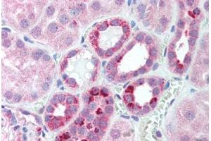 Human Kidney (formalin-fixed, paraffin-embedded) stained with SERTAD1 antibody ABIN214142 at 5 ug/ml followed by biotinylated goat anti-rabbit IgG secondary antibody ABIN481713, alkaline phosphatase-streptavidin and chromogen. (SERTAD1 antibody  (N-Term))
