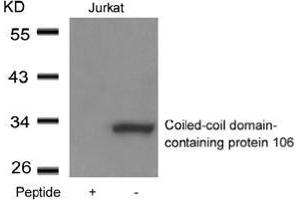 Western blot analysis of extracts from Jurkat cells using Coiled-coil domain-containing protein 106and the same antibody preincubated with blocking peptide. (CCDC106 antibody  (Coiled coil domain))