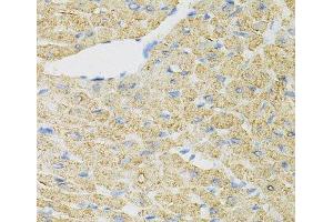 Immunohistochemistry of paraffin-embedded Mouse heart using INPP5J Polyclonal Antibody at dilution of 1:100 (40x lens).