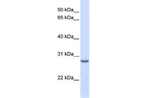 WB Suggested Anti-TSPAN6 Antibody Titration:  0.
