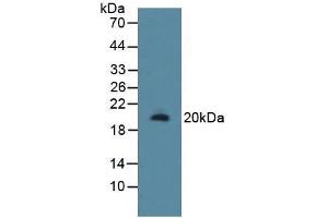 Figure. (RSPO1 antibody  (AA 136-262))