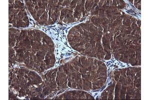 Image no. 4 for anti-DEAD (Asp-Glu-Ala-Asp) Box Polypeptide 58 (DDX58) antibody (ABIN1500708)