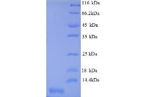 SDS-PAGE (SDS) image for Chemokine (C-X-C Motif) Ligand 3 (CXCL3) (AA 32-100) protein (His tag) (ABIN5712666) (CXCL3 Protein (AA 32-100) (His tag))