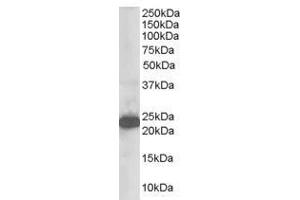 Image no. 1 for anti-Stathmin-Like 2 (STMN2) (N-Term) antibody (ABIN374200) (STMN2 antibody  (N-Term))