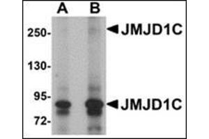 Western blot analysis of JMJD1C in human liver tissue lysate with this product at (A) 1 and (B) 2 μg/ml.