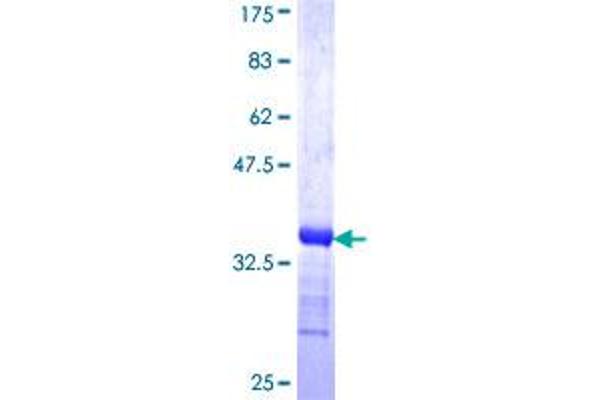 TRA2B Protein (AA 120-199) (GST tag)