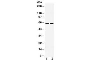 Western blot testing of 1) rat testis and 2) human MCF7 lysate with ACCN1 antibody at 0. (ACCN1 antibody  (AA 112-147))