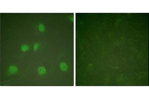 Immunofluorescence analysis of HeLa cells, treated with A (125 ng/mL, 30 mins), using Cullin 1 antibody. (Cullin 1 antibody)