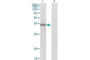 Western Blot analysis of SPRY1 expression in transfected 293T cell line by SPRY1 monoclonal antibody (M01), clone 3H4. (SPRY1 antibody  (AA 1-110))