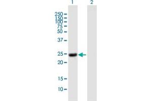 Western Blot analysis of NOG expression in transfected 293T cell line by NOG MaxPab polyclonal antibody. (NOG antibody  (AA 1-232))