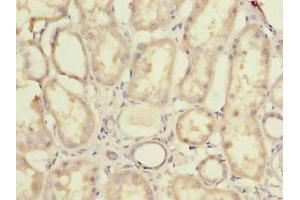 Immunohistochemistry of paraffin-embedded human kidney tissue using ABIN7142419 at dilution of 1:100 (MRPL44 antibody  (AA 31-332))