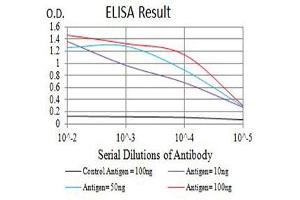 Black line: Control Antigen (100 ng),Purple line: Antigen (10 ng), Blue line: Antigen (50 ng), Red line:Antigen (100 ng) (IL2 Receptor beta antibody  (AA 27-240))