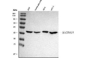 Western blot analysis of SLC25A24 using anti-SLC25A24 antibody (ABIN7599228).