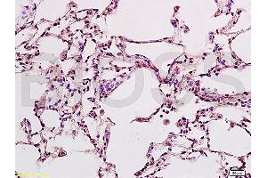 Formalin-fixed and rat lung tissue labeled with Anti-B7-H1/PD-L1/CD274 Polyclonal Antibody, Unconjugated (ABIN737706) at 1:200 followed by conjugation to the secondary antibody and DAB staining (PD-L1 antibody  (AA 201-290))