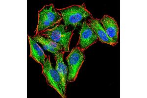 Fig. (PKN1 antibody  (AA 442-620))