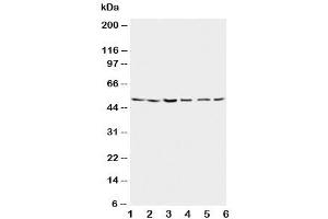 Western blot testing of Presenilin 2 antibody and Lane 1:  rat brain