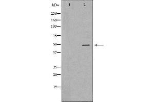 Western blot analysis of extracts from Hela  using KRT20 Antibody. (KRT20 antibody  (C-Term))