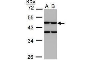 WB Image Sample(30 ug whole cell lysate) A:H1299 B:HeLa S3, 10% SDS PAGE antibody diluted at 1:1000 (CKMT1B antibody)