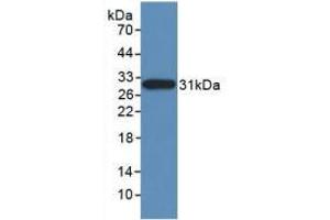Figure. (Nestin antibody  (AA 178-399))