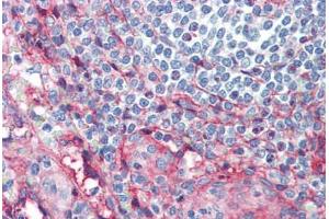 Human Spleen (formalin-fixed, paraffin-embedded) stained with ICAM1 antibody ABIN462119 followed by biotinylated anti-mouse IgG secondary antibody ABIN481714, alkaline phosphatase-streptavidin and chromogen. (ICAM1 antibody)