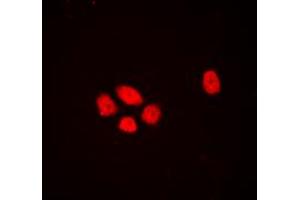Immunofluorescent analysis of DLX3 staining in HEK293T cells. (DLX3 antibody  (Center))