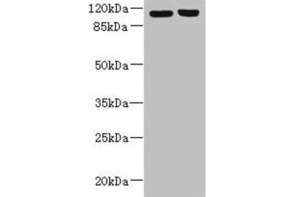 RPGR Antikörper  (AA 1-180)