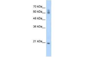 FIP1L1 antibody used at 0. (FIP1L1 antibody)