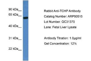 WB Suggested Anti-TCHP  Antibody Titration: 0. (TCHP antibody  (C-Term))