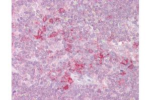 Anti-MST4 antibody IHC of human thymus. (STK26/MST4 antibody  (AA 340-354))