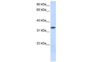MRPL15 antibody used at 1 ug/ml to detect target protein. (MRPL15 antibody  (C-Term))