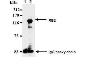 Western Blotting (WB) image for anti-Retinoblastoma-Like 2 (p130) (RBL2) antibody (ABIN487489) (p130 antibody)