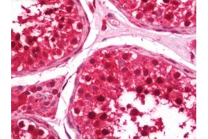 Human Testis: Formalin-Fixed, Paraffin-Embedded (FFPE) (UBR7 antibody  (AA 1-50))