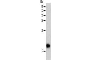 Gel: 12 % SDS-PAGE, Lysate: 40 μg, Lane: Human liver cancer tissue, Primary antibody: ABIN7128688(BTG2 Antibody) at dilution 1/200, Secondary antibody: Goat anti rabbit IgG at 1/8000 dilution, Exposure time: 10 minutes (BTG2 antibody)